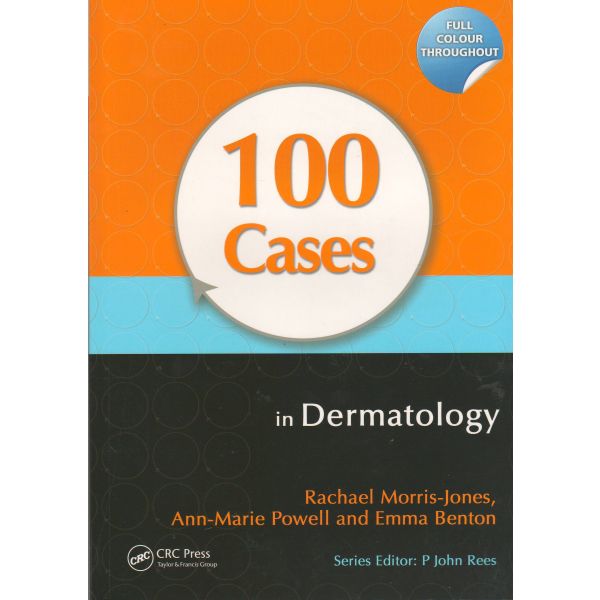 100 CASES IN DERMATOLOGY