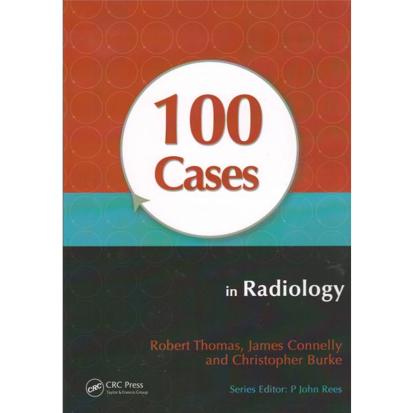 100 CASES IN RADIOLOGY