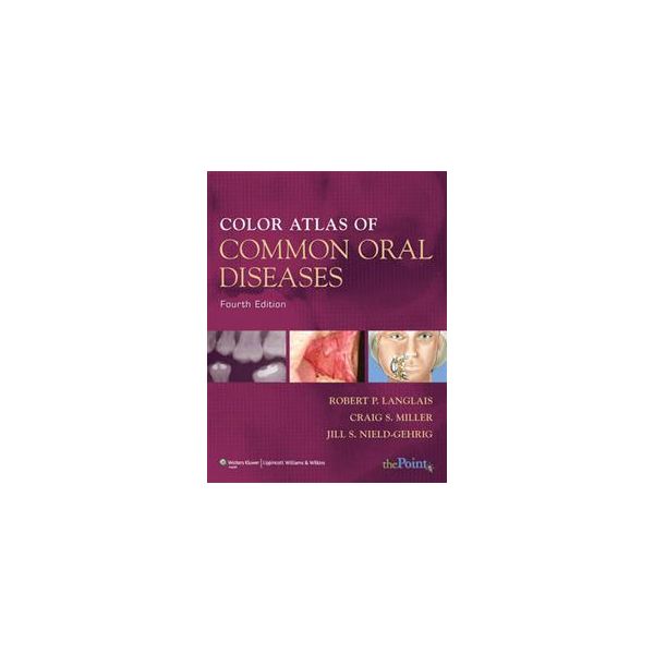 COLOR ATLAS OF COMMON ORAL DISEASES, 4th Edition