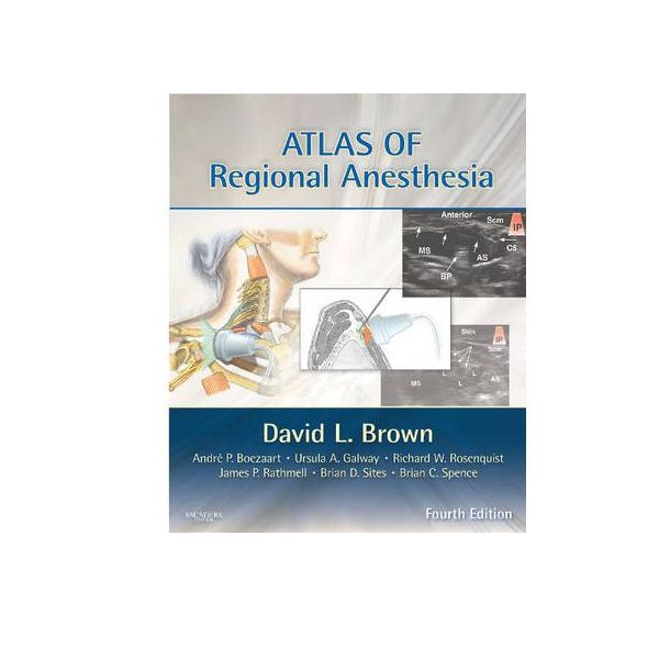 ATLAS OF REGIONAL ANESTHESIA: 4th Edition