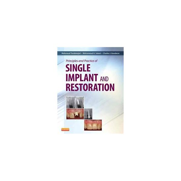 PRINCIPLES AND PRACTICE OF SINGLE IMPLANT AND RE