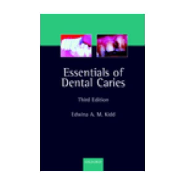 ESSENTIALS OF DENTAL CARIES. 3rd ed..