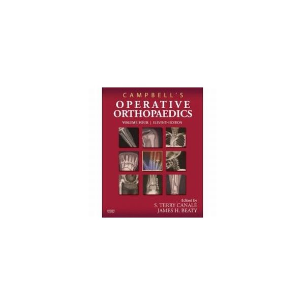CAMPBELL`S OPERATIVE ORTHOPAEDICS.  In 4 vol. 11