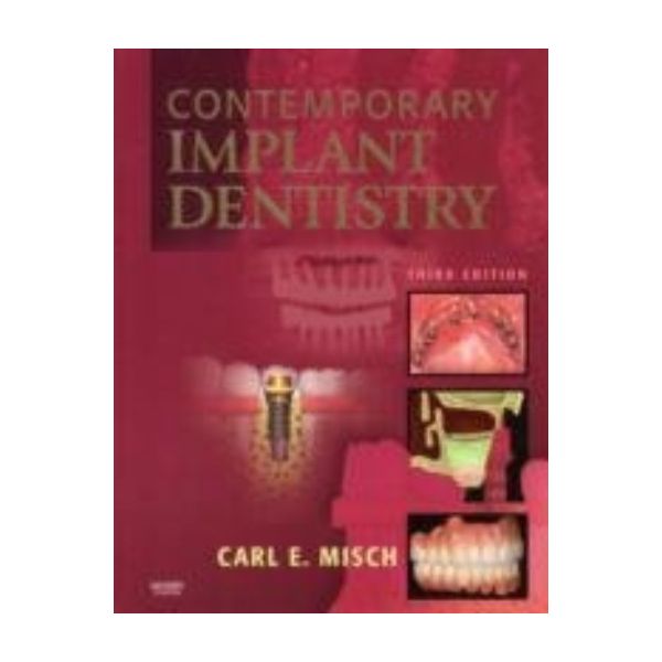 CONTEMPORARY IMPLANT DENTISTRY. 3rd ed. (C.Misch