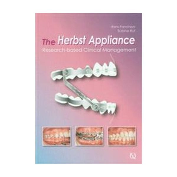 HERBST APPLIANCE_THE: Research-based Clinical Ma