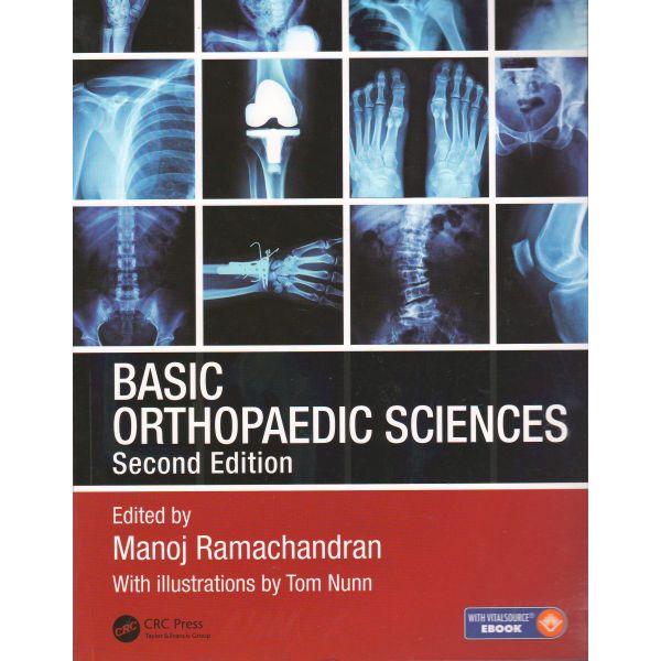BASIC ORTHOPAEDIC SCIENCES, 2nd Edition