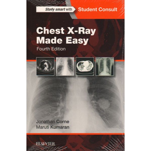 CHEST X-RAY MADE EASY, 4th Edition