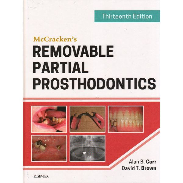MCCRACKEN`S REMOVABLE PARTIAL PROSTHODONTICS, 13th Edition