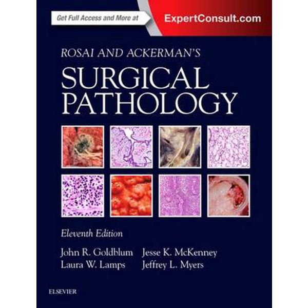 ROSAI AND ACKERMAN`S SURGICAL PATHOLOGY - 2 Volume Set