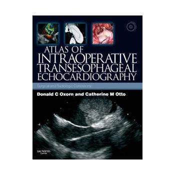ATLAS OF INTRAOPERATIVE TRANSESOPHAGEAL ECHOCARD