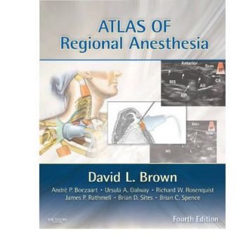 ATLAS OF REGIONAL ANESTHESIA: 4th Edition