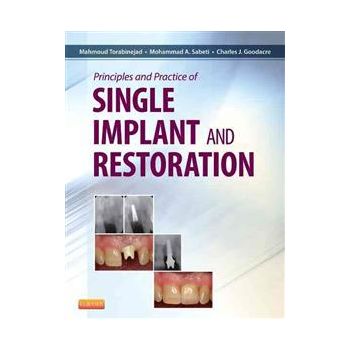 PRINCIPLES AND PRACTICE OF SINGLE IMPLANT AND RE