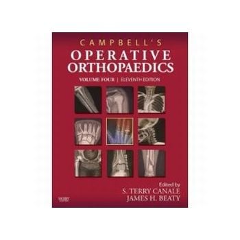 CAMPBELL`S OPERATIVE ORTHOPAEDICS.  In 4 vol. 11