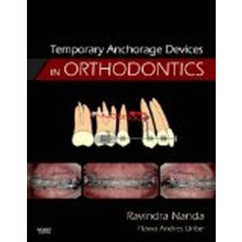 TEMPORARY ANCHORAGE DEVICES IN ORTHODONTICS. (Ra