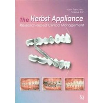 HERBST APPLIANCE_THE: Research-based Clinical Ma