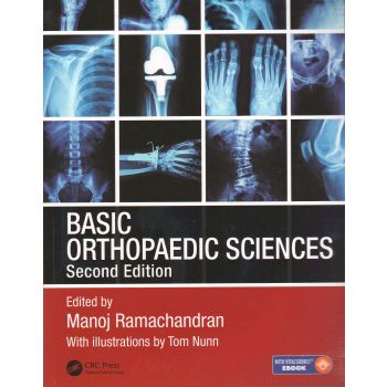 BASIC ORTHOPAEDIC SCIENCES, 2nd Edition