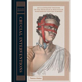 CRUCIAL INTERVENTIONS: An Illustrated Treatise on the Principles and Practice of Nineteenth Century Surgery