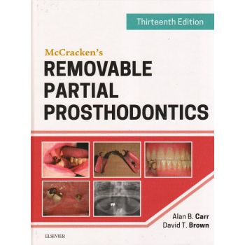 MCCRACKEN`S REMOVABLE PARTIAL PROSTHODONTICS, 13th Edition
