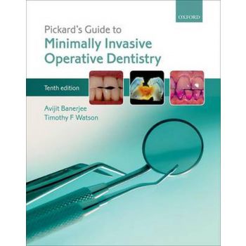 PICKARD`S GUIDE TO MINIMALLY INVASIVE OPERATIVE DENTISTRY