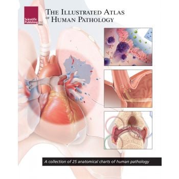 THE ILLUSTRATED ATLAS OF HUMAN PATHOLOGY: A Collection of 25 Anatomical Charts of Human Pathology