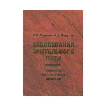 Заболевания зрительного пути. Клиника. Диагности