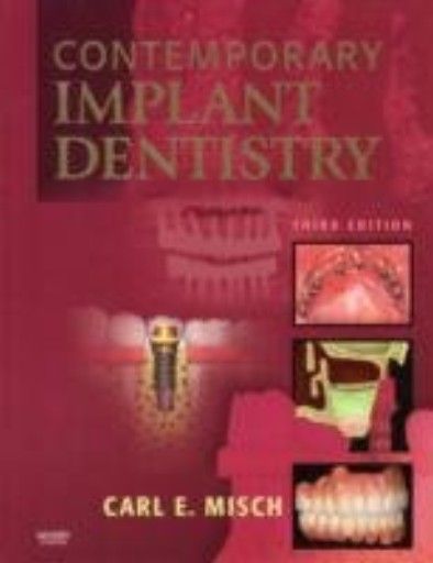 CONTEMPORARY IMPLANT DENTISTRY. 3rd ed. (C.Misch