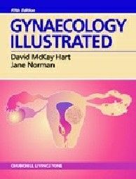 GYNAECOLOGY ILLUSTRATED. 5th ed. (D.Hart), PB